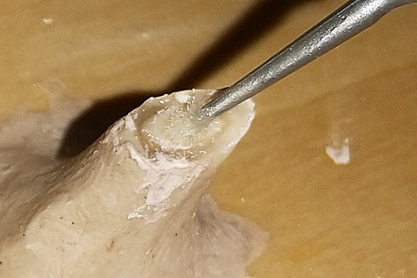 犬歯カット